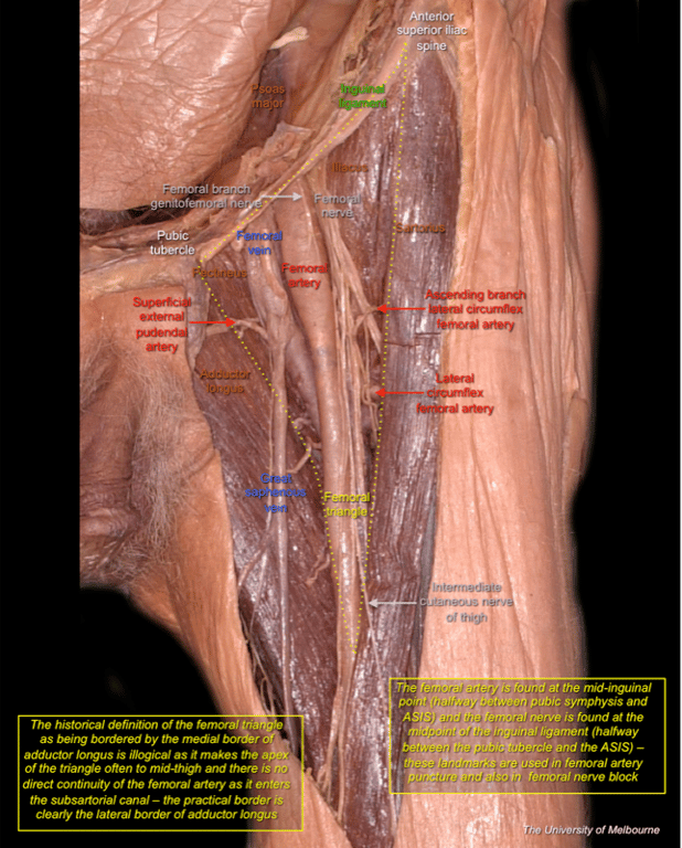 Femoral Region — MRCS Part B Anatomy