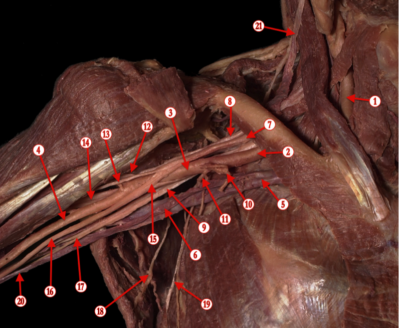 Brachial Plexus 2 — MRCS Part B Anatomy