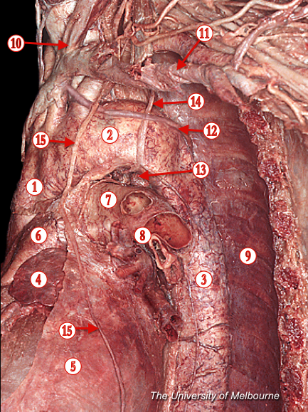 Mediastinum 2 — MRCS Part B Anatomy