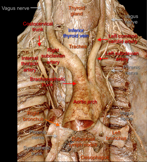 Trachea — MRCS Part B Anatomy