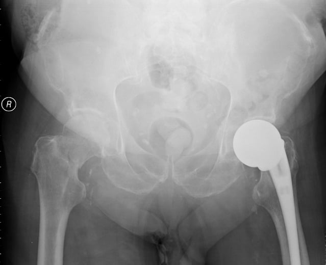 Hip — Describe the radiograph
