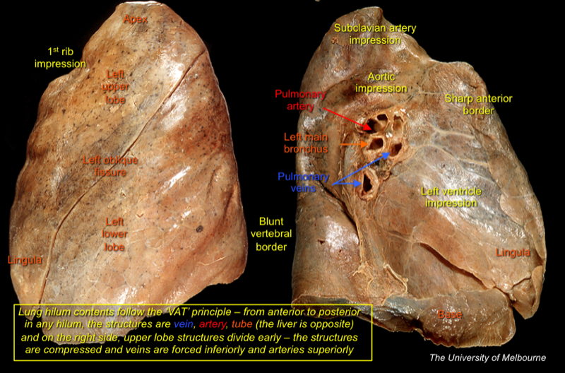 Lungs — MRCS Part B Anatomy