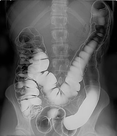Large Intestine — Describe the different sections of the colon