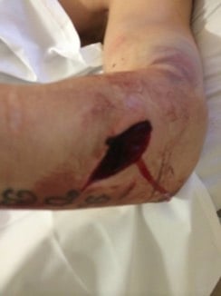 Suturing — MRCS Part B Procedural and technical skills