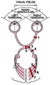 Nervous System — MRCS Part B Anatomy
