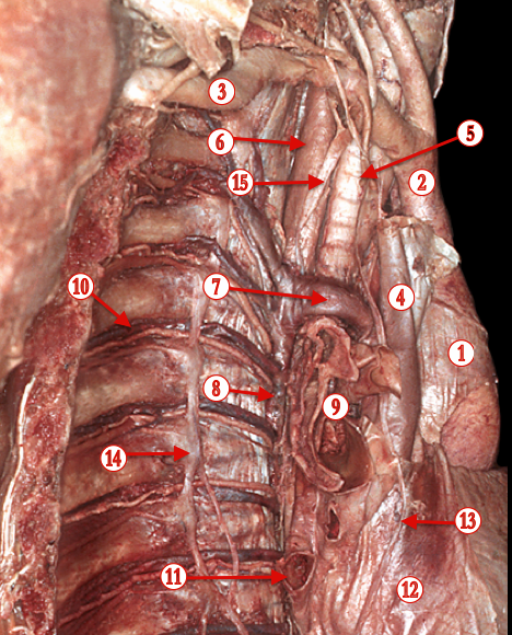 Mediastinum 2 — MRCS Part B Anatomy