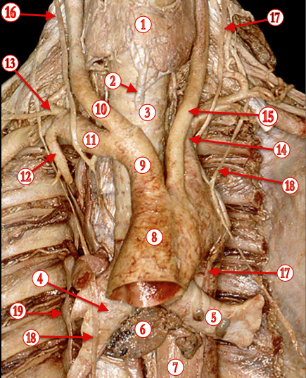 Trachea — MRCS Part B Anatomy