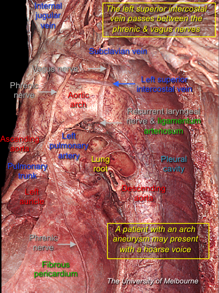 Mediastinum 2 — MRCS Part B Anatomy