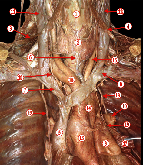 Mediastinum 1 — MRCS Part B Anatomy