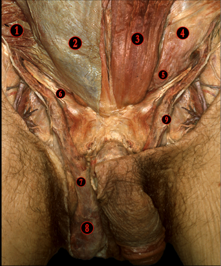 Inguinal Region — MRCS Part B Anatomy
