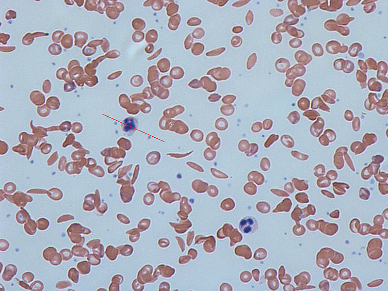 Anaemia — What does the blood film demonstrate?