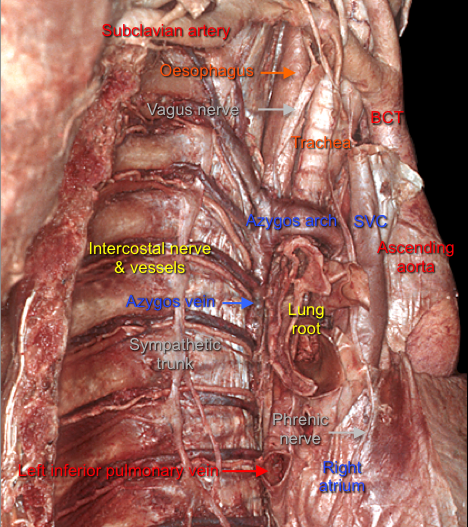 Mediastinum 2 — MRCS Part B Anatomy