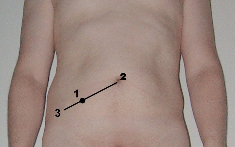 Large Intestine — MRCS Part B Anatomy