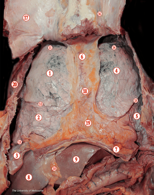 Pleural Cavity — MRCS Part B Anatomy