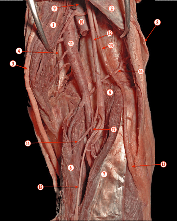Popliteal Fossa — MRCS Part B Anatomy