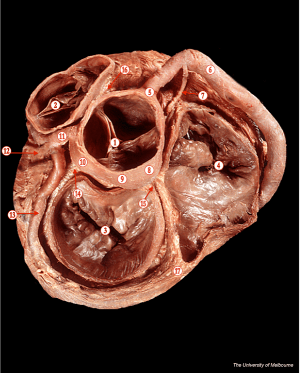 Heart 3 — MRCS Part B Anatomy