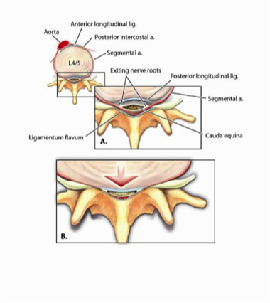 Haematology — MRCS Part B Surgical pathology