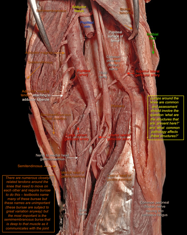 Popliteal Fossa — MRCS Part B Anatomy