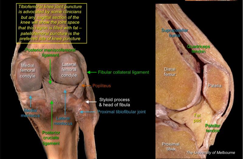 Knee 1 — MRCS Part B Anatomy