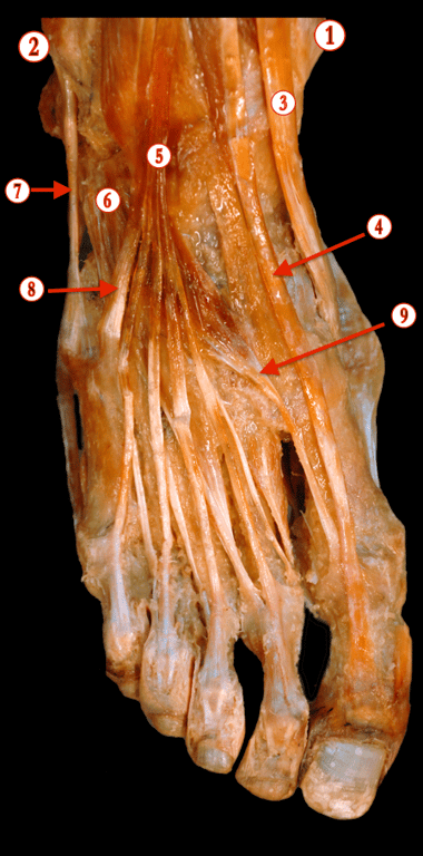 Foot — MRCS Part B Anatomy spot tests