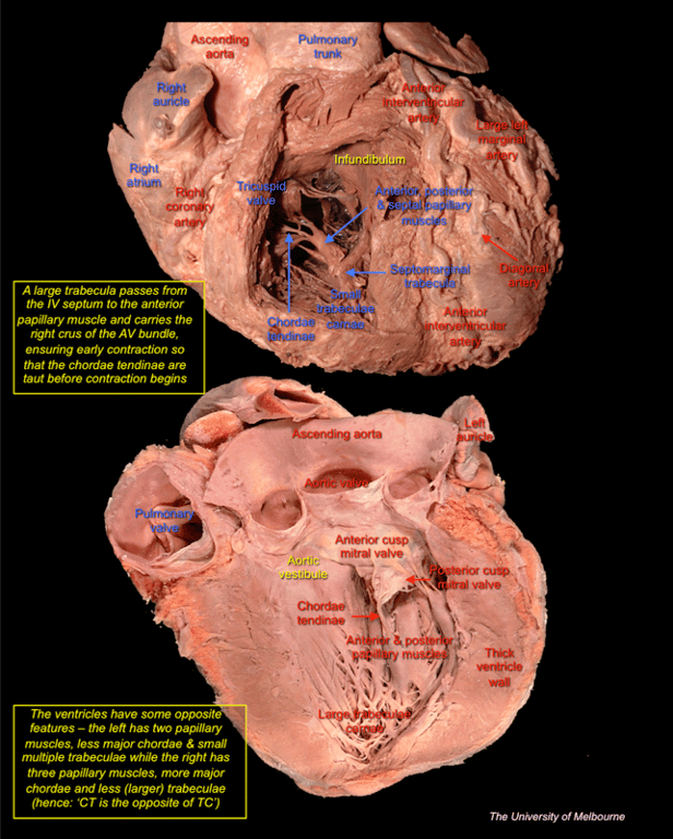 Heart 2 — MRCS Part B Anatomy