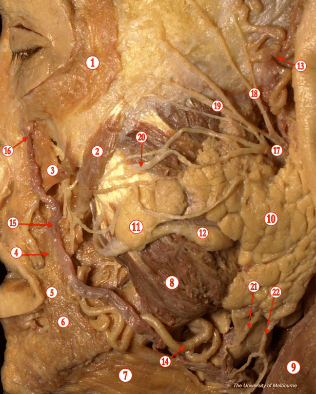 Parotid Gland — MRCS Part B Anatomy
