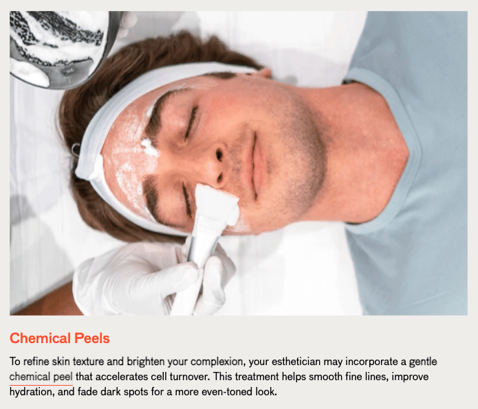 Chemical Peels