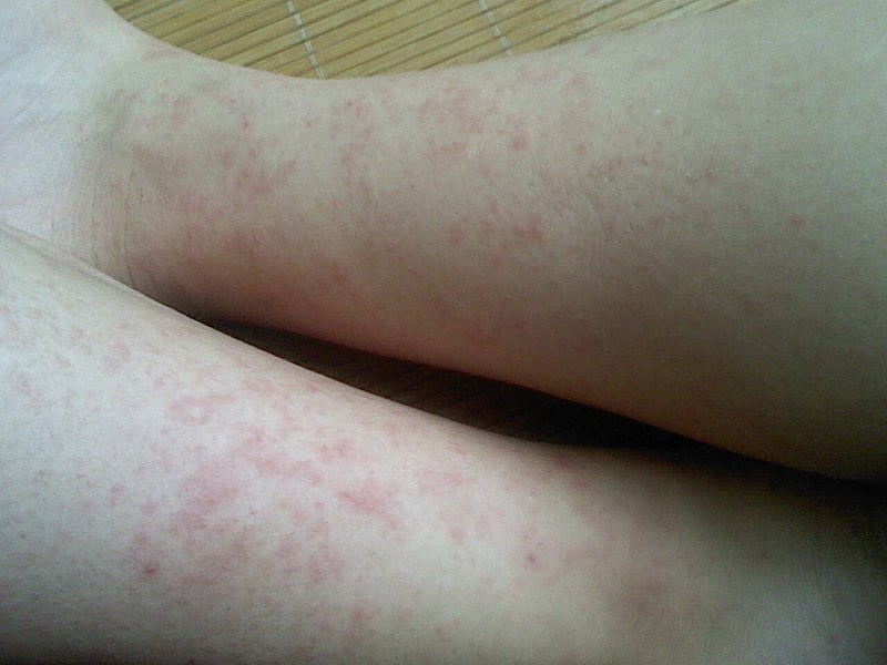 生病时有人带你去医院