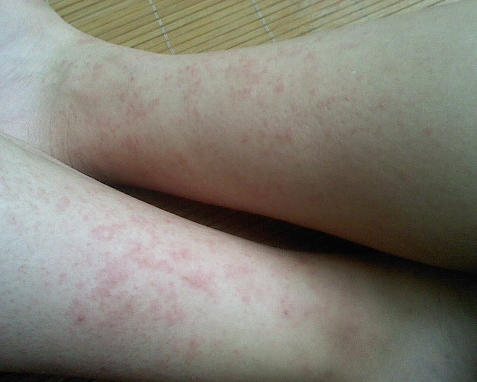 生病时有人带你去医院