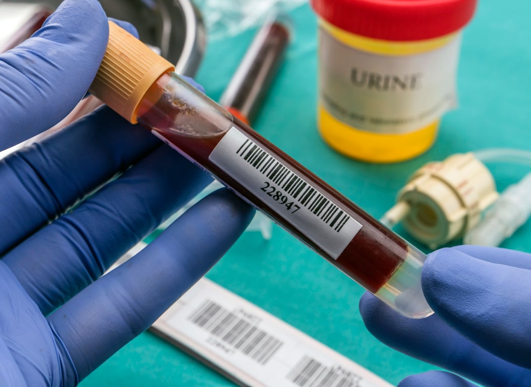 Blood Lead Level (Pb): Normal Range Explained