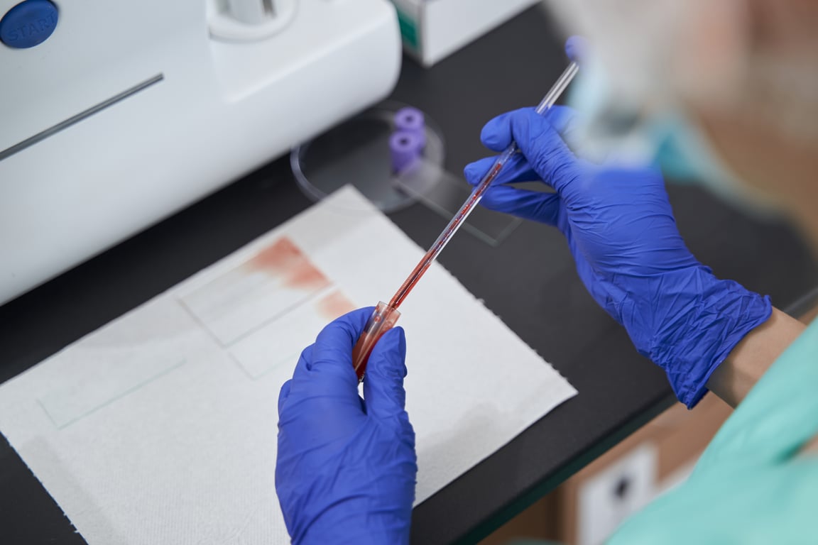 Albumin (ALB) Blood Test: Normal Range, High & Low