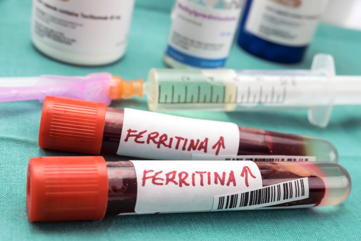 Ferritin Test: Normal Range, High & Low Levels
