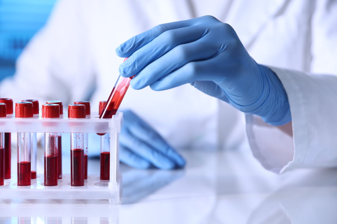 Bicarbonate (CO2) Blood Test: Normal Range