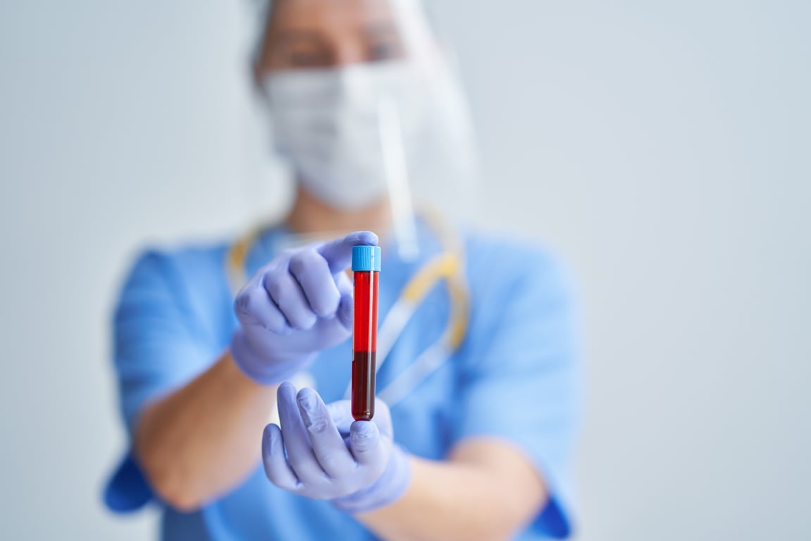 Total Protein (TP) Blood Test: Normal Range Explained