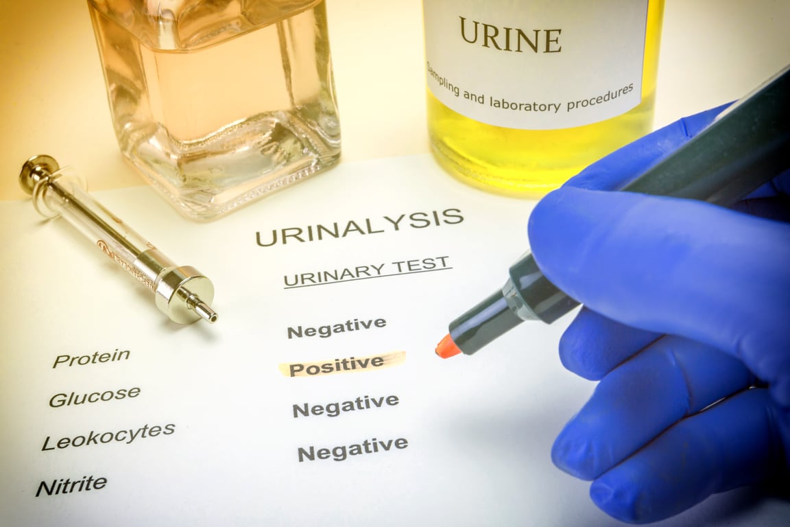 Urine Arsenic: Normal Range Explained