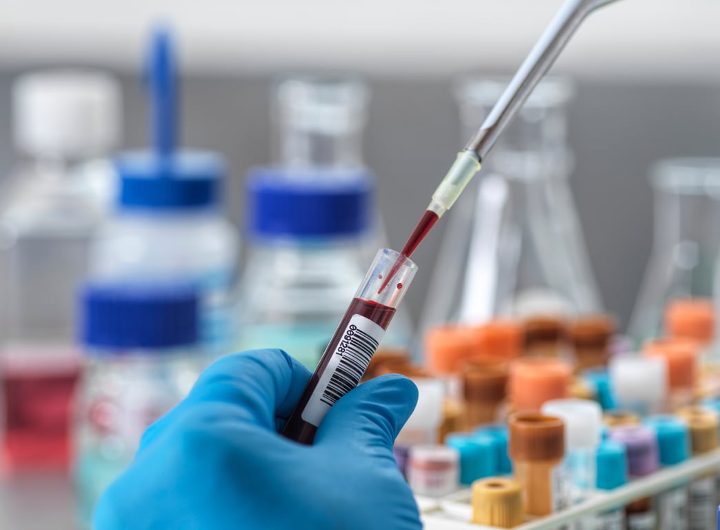 Alkaline Phosphatase (ALP) Normal Range Explained