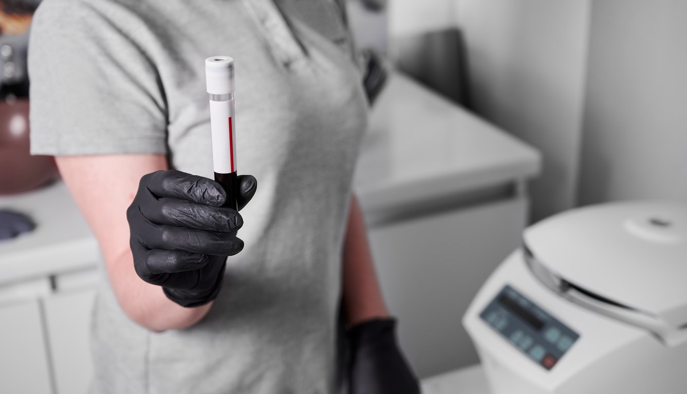 Chloride (Cl) Blood Test: Normal Range, High & Low