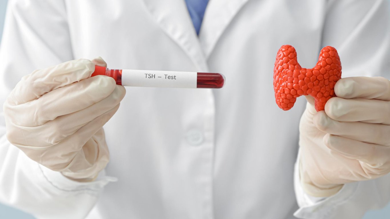Thyroid Stimulating Immunoglobulin (TSI) Normal Range