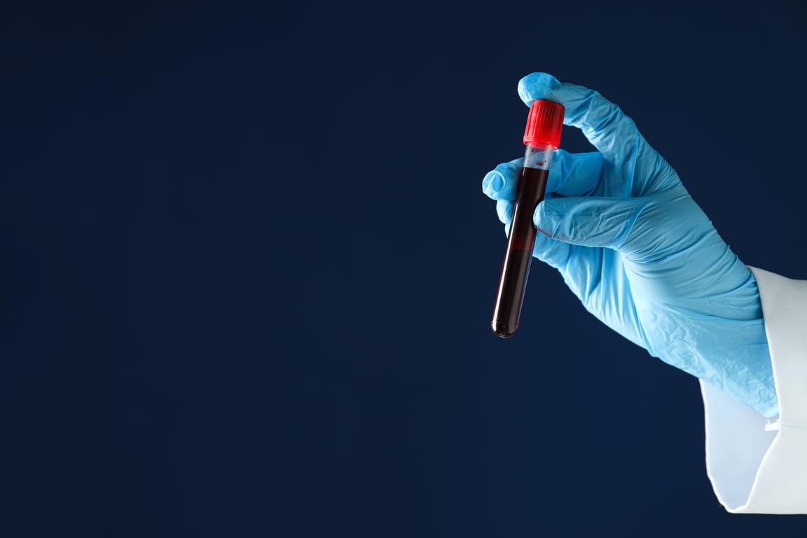 Blood Mercury (Hg): Normal Range, Causes & Safety
