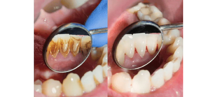 Global Dental, photo 3