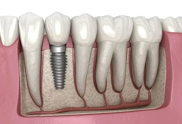 Dr.Taruni’s Dental Care, photo 3