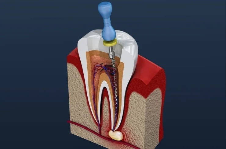 Reliable Superspeciality Dental care & Implant centre, photo 2