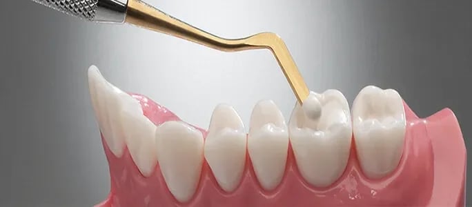Prudentoe Dental, photo 2