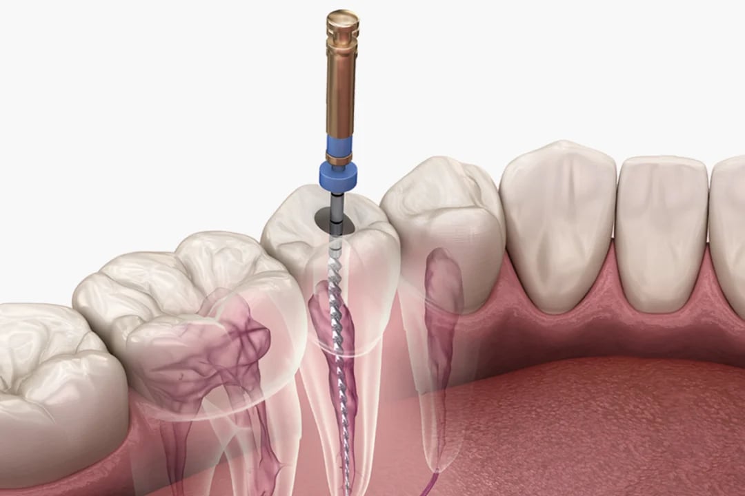 Apollo Dental Clinic, Kokapet, photo 2