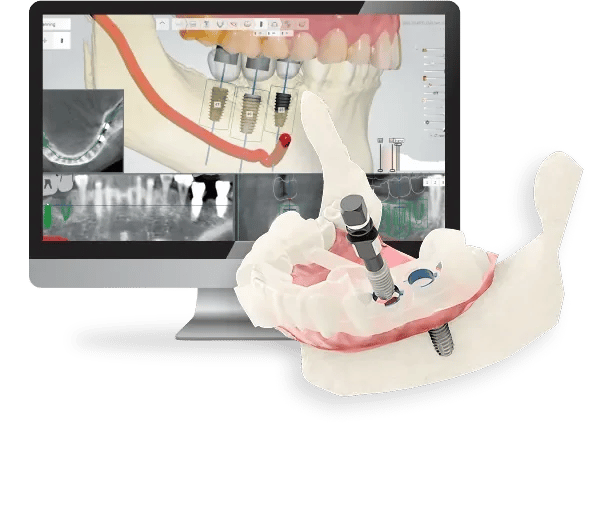 J V Dental and Implant Centre, photo 2