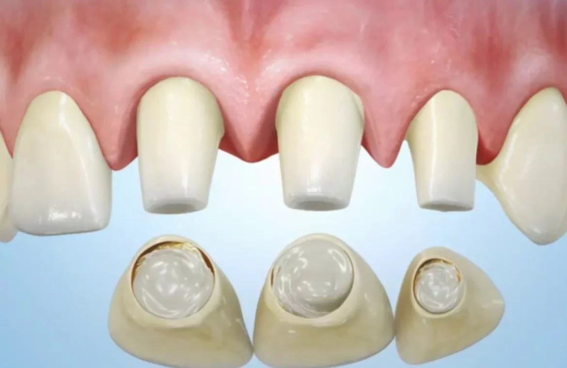 GK DENTAL - Gachibowli, photo 2