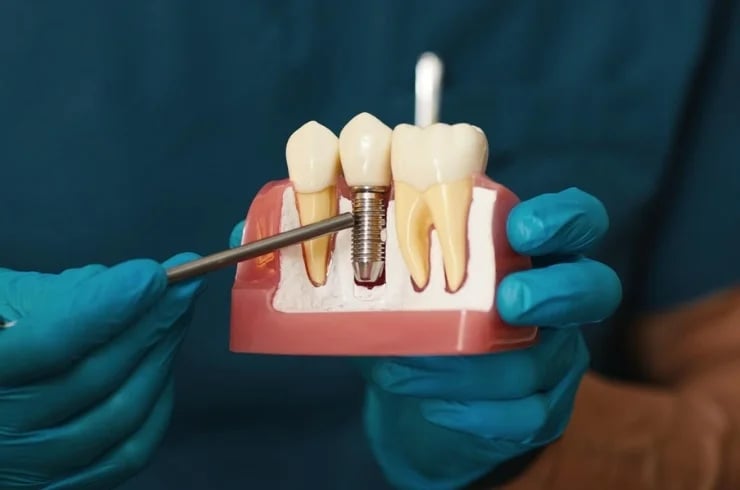 Mana Dental Clinics - Hayathnagar, photo 2