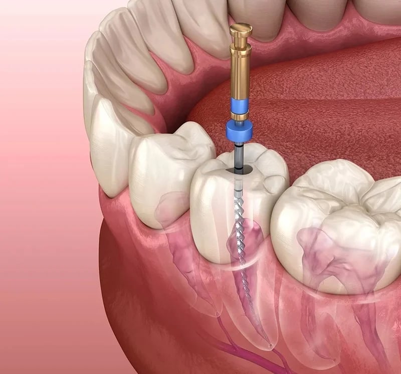 Navya Dental KPHB, photo 3
