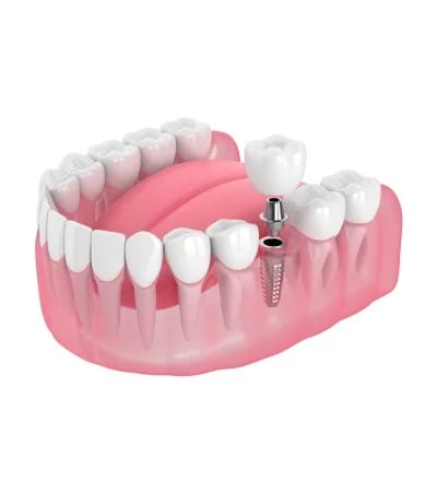 Vakratunda Dental Care, photo 2