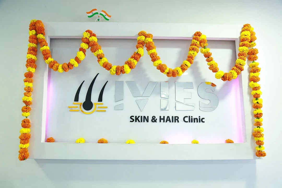 Hair Transplant Clinic Dilsukhnagar - Ivies, photo 2